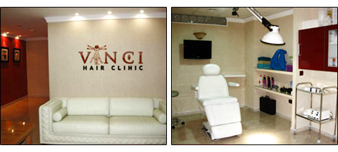 Vinci Hair Clinic Malaga